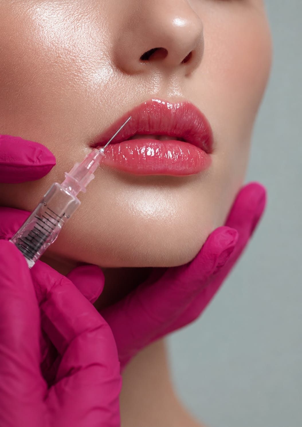 Preenchimento labial com ácido hialurônico